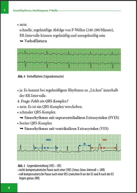 EKG-Befund-in-5-Schritten - Seite 4