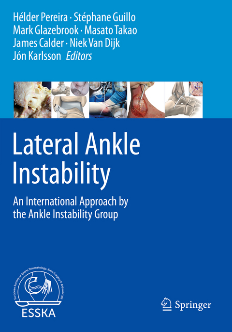 Lateral Ankle Instability - 