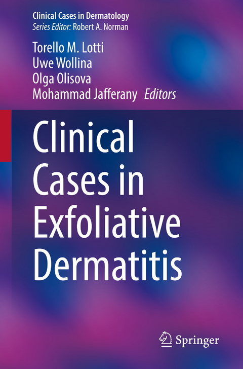 Clinical Cases in Exfoliative Dermatitis - 