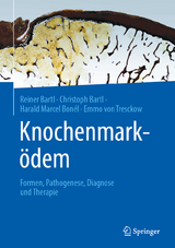 Knochenmarködem - Reiner Bartl, Christoph Bartl, Harald Marcel Bonél, Emmo Von Tresckow