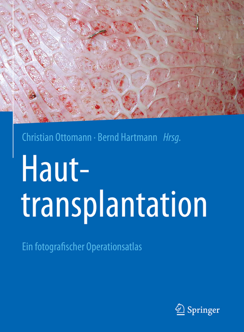 Hauttransplantation - 