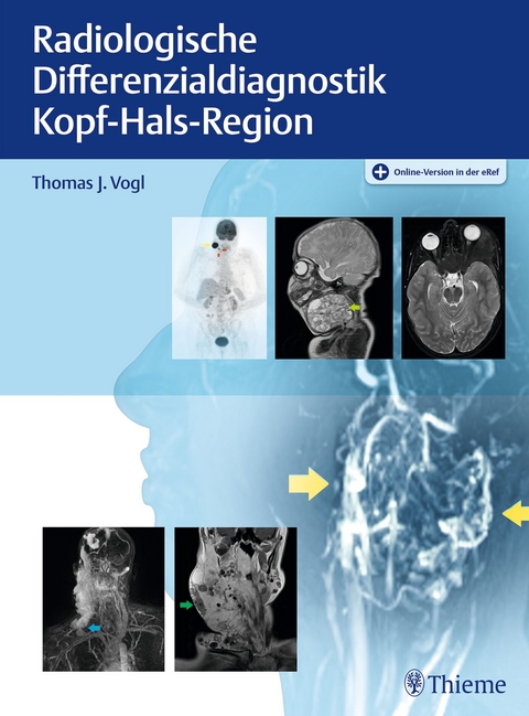 Radiologische Differenzialdiagnostik Kopf-Hals-Region - 