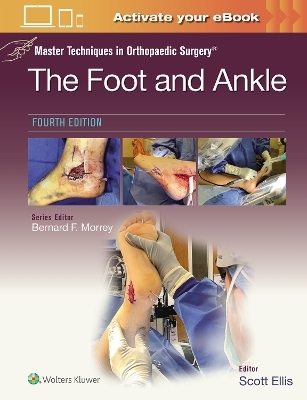 Master Techniques in Orthopaedic Surgery: The Foot and Ankle: Print + eBook with Multimedia - Scott Ellis