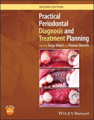 Practical Periodontal Diagnosis and Treatment Planning - Serge Dibart; Thomas Dietrich