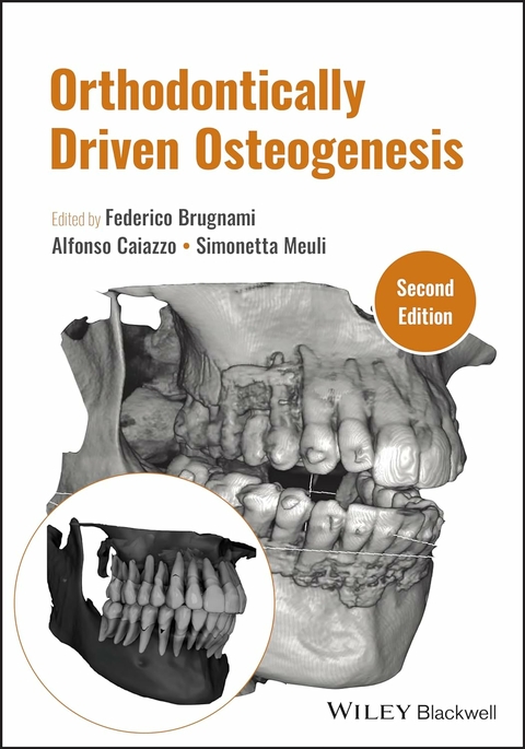 Orthodontically Driven Osteogenesis - 