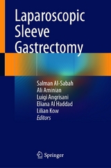 Laparoscopic Sleeve Gastrectomy - 