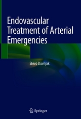 Endovascular Treatment of Arterial Emergencies -  Stevo Duvnjak