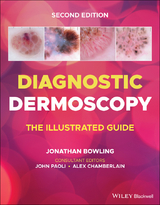 Diagnostic Dermoscopy - 