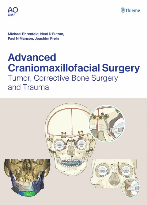Advanced Craniomaxillofacial Surgery - 