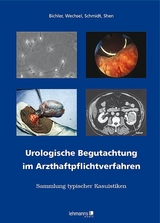 Urologische Begutachtung im Arzthaftpflichtverfahren - Karl-Horst Bichler, Hans W. Wechsel