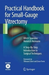Practical Handbook for Small-Gauge Vitrectomy - Ulrich Spandau, Heinrich Heimann
