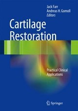 Cartilage Restoration - 