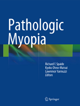Pathologic Myopia - 