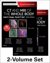 CT and MRI of the Whole Body, 2-Volume Set - Haaga, John R.; Boll, Daniel