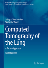 Computed Tomography of the Lung - Verschakelen, Johny A.; de Wever, Walter