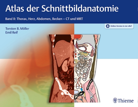 Atlas der Schnittbildanatomie, Band 2: Thorax, Herz, Abdomen, Becken - Torsten Bert Möller, Emil Reif