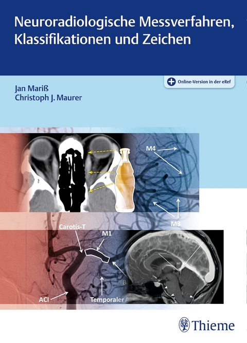 Neuroradiologische Messverfahren, Klassifikationen und Zeichen - Jan Mariß, Christoph J. Maurer