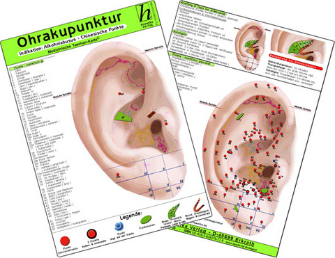 Ohrakupunktur - Indikation: Kopfschmerzen / Spannungskopfschmerz - chinesische Ohrakupunktur / Medizinische Taschen-Karte