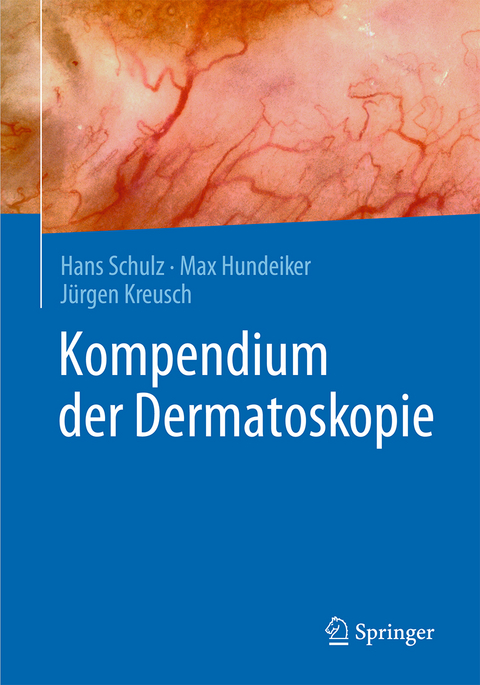 Kompendium der Dermatoskopie - Hans Schulz, Max Hundeiker, Jürgen Kreusch
