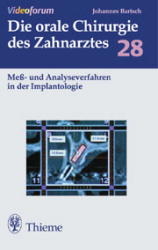 Meßverfahren und Analyseverfahren in der Implantologie - Johannes K. Bartsch