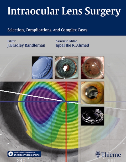 Intraocular Lens Surgery - Bradley Randleman, Iqbal Ike K Ahmed