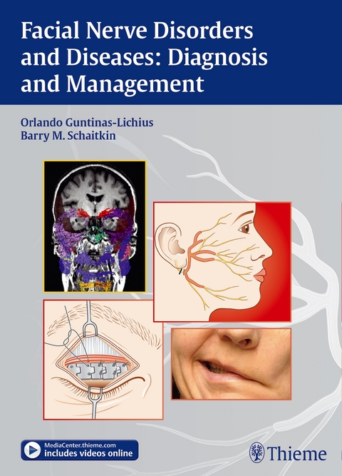 Facial Nerve Disorders and Diseases: Diagnosis and Management - Orlando Guntinas-Lichius, Barry Schaitkin