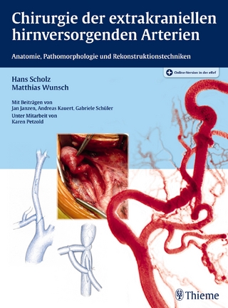 Chirurgie der extrakraniellen hirnversorgenden Arterien - Hans Scholz; Matthias Wunsch