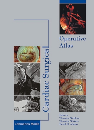 Cardiac Surgical Operative Atlas - Thorsten Wahlers; Thorsten Wittwer; David H Adams