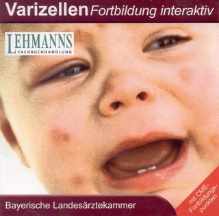 Varizellen - Bayerische Landesärztekammer