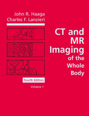CT and MR Imaging of the Whole Body - John R. Haaga, Charles F. Lanzieri, Robert C. Gilkeson