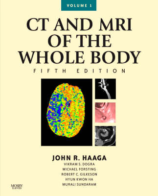 CT and MRI of the Whole Body - Daniel Boll, John R. Haaga