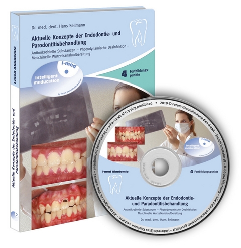 Aktuelle Konzepte der Endodontie- und Parodontitisbehandlung - Hans Dr. med. dent Sellmann