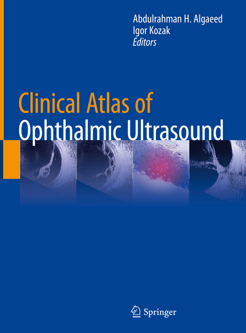 Clinical Atlas of Ophthalmic Ultrasound - 