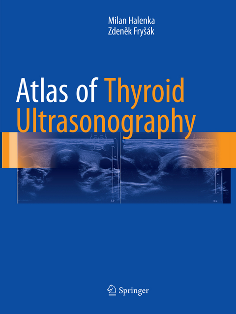 Atlas of Thyroid Ultrasonography - Milan Halenka, Zdeněk Fryšák