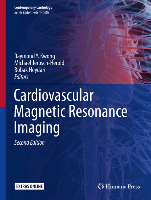 Cardiovascular Magnetic Resonance Imaging - 