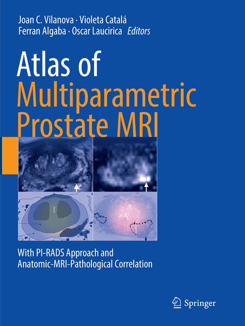 Atlas of Multiparametric Prostate MRI - 