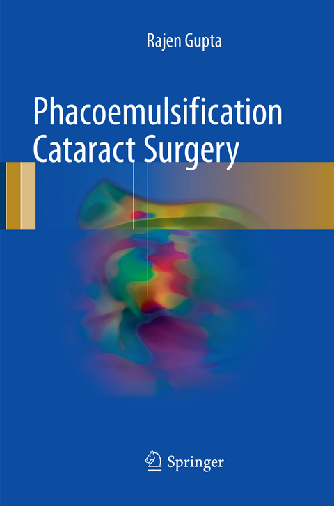 Phacoemulsification Cataract Surgery - Rajen Gupta