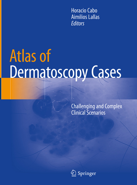 Atlas of Dermatoscopy Cases - 