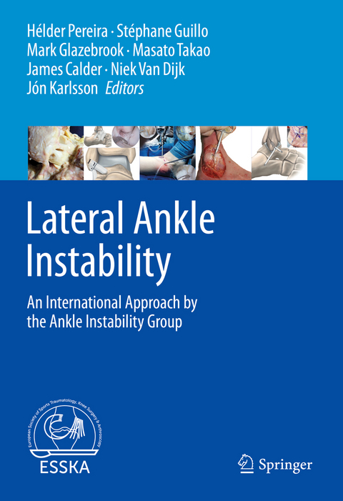 Lateral Ankle Instability - 
