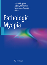 Pathologic Myopia - Spaide, Richard F.; Ohno-Matsui, Kyoko; Yannuzzi, Lawrence A.