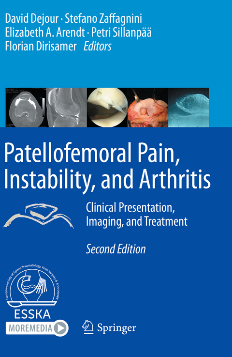 Patellofemoral Pain, Instability, and Arthritis - 