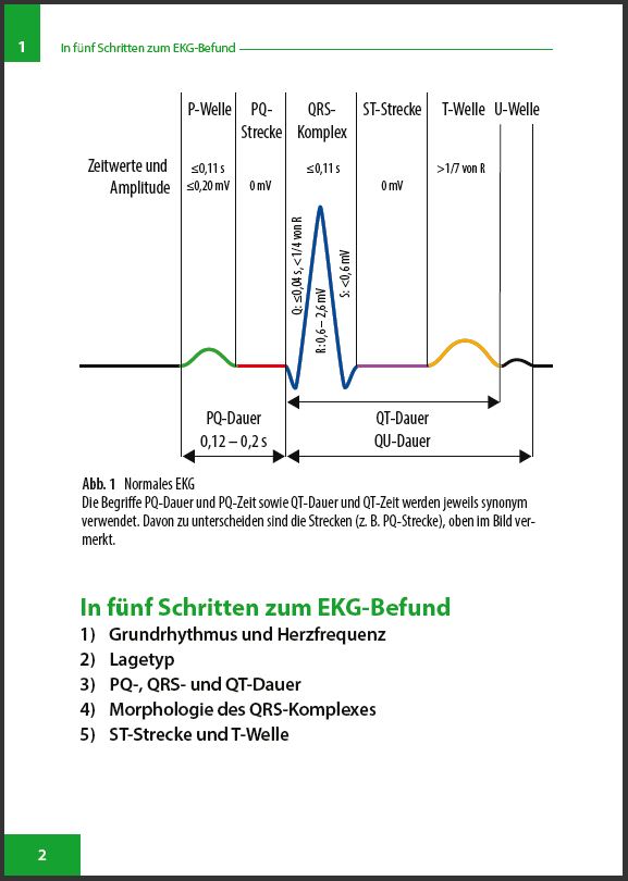 EKG-Befund-in-5-Schritten - Seite 2
