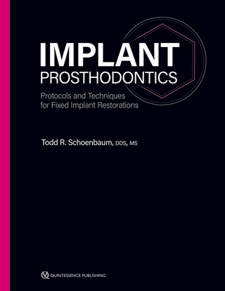 Implant Prosthodontics