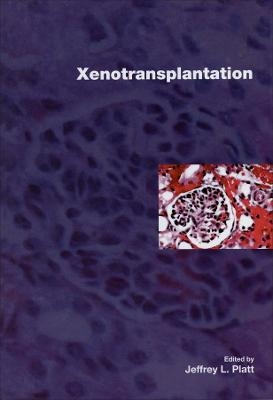 Xenotransplantation - JL Platt