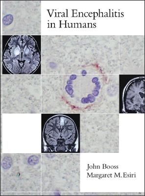 Viral Encephalitis in Humans
