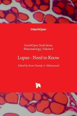 Lupus - 