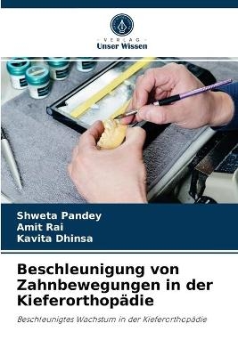 Beschleunigung von Zahnbewegungen in der Kieferorthop&auml;die - Shweta Pandey, Amit Rai, Kavita Dhinsa
