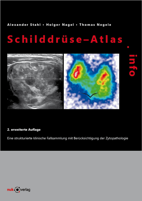 Schilddrüse-Atlas.info - 