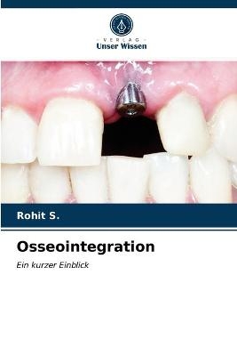 Osseointegration