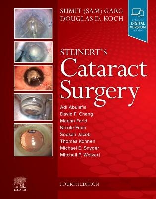 Steinert's Cataract Surgery